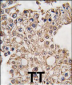 GRK4 Antibody (C-term)